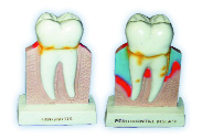 Molar Figure