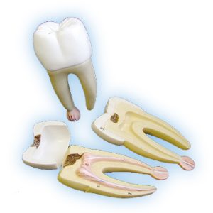 Tooth Model